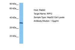 BXDC1 Antibody, Novus Biologicals 100 &mu;L; Unconjugated:Antibodies, Polyclonal